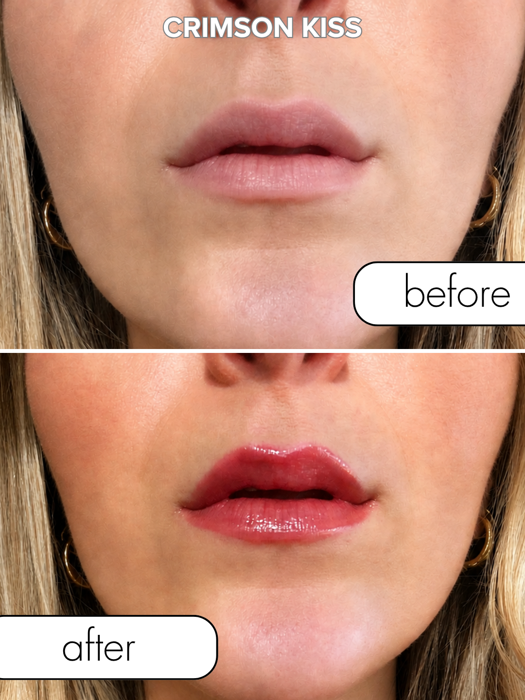 Matchmaker Kiss Chemistry Lip Gloss Bundle