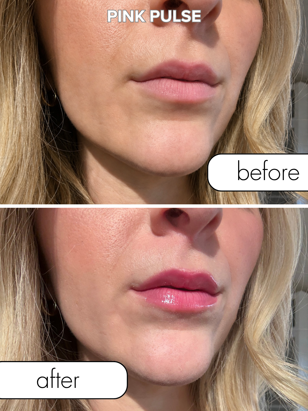Matchmaker Kiss Chemistry Lip Gloss Bundle